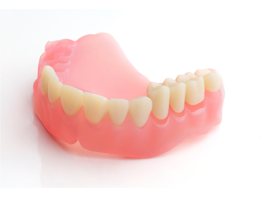 サートマーのUV硬化樹脂を用いて3Dプリンターで作られた義歯